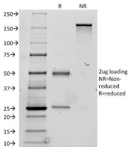 SDS-PAGE analysis of Anti-Thyroglobulin Antibody [TGB24] under non-reduced and reduced conditions; showing intact IgG and intact heavy and light chains, respectively. SDS-PAGE analysis confirms the integrity and purity of the antibody.