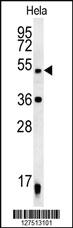 Anti-DDX47 Rabbit Polyclonal Antibody