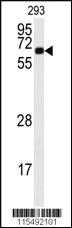 Anti-CAMK2A Rabbit Polyclonal Antibody