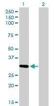 Anti-ZNF124 Mouse Monoclonal Antibody [clone: 4G4]