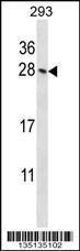 Anti-HOXB4 Rabbit Polyclonal Antibody (AP (Alkaline Phosphatase))