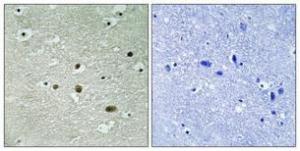 Immunohistochemical analysis of paraffin-embedded human brain using Anti-NPM (phospho Thr234) Antibody 1:100 (4°C overnight) The right hand panel represents a negative control, where the antibody was pre-incubated with the immunising peptide