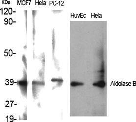 Western blot analysis of various cells using Anti-ALDOB Antibody