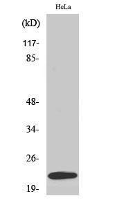 Western blot analysis of various cells using Anti-UBE2T Antibody