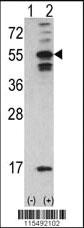 Anti-CAMK2A Rabbit Polyclonal Antibody