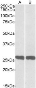 EB10220 (0.01 µg/ml) staining of Mouse (A) and Rat (B) Brain lysate (35 µg protein in RIPA buffer). Primary incubation was 1 hour. Detected by chemiluminescence.