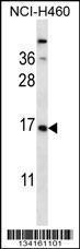 Anti-CSRP2 Rabbit Polyclonal Antibody (FITC (Fluorescein Isothiocyanate))