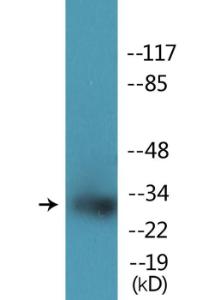 Anti-Nucleophosmin Rabbit Polyclonal Antibody