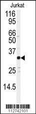 Anti-JUND Rabbit Polyclonal Antibody