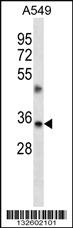 Anti-TMBIM1 Rabbit Polyclonal Antibody