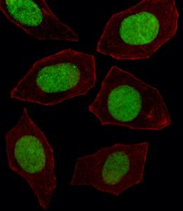 Anti-EN1 Rabbit Polyclonal Antibody (AP (Alkaline Phosphatase))