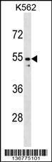 Anti-PAX2 Rabbit Polyclonal Antibody (HRP (Horseradish Peroxidase))