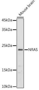 Western blot analysis of extracts of Mouse brain, using Anti-NRAS Antibody (A15785) at 1:1,000 dilution. The secondary antibody was Goat Anti-Rabbit IgG H&L Antibody (HRP) at 1:10,000 dilution.