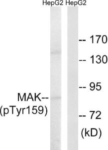 Western blot analysis of lysates from HepG2 cells treated with PMA 125ng/ml 30' using Anti-MAK (phospho Tyr159) Antibody. The right hand lane represents a negative control, where the antibody is blocked by the immunising peptide