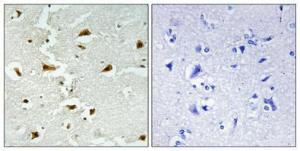 Immunohistochemical analysis of paraffin-embedded human brain using Anti-ALDOB Antibody 1:100 (4 °C overnight). The right hand panel represents a negative control, where the antibody was pre-incubated with the immunising peptide