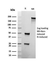 Anti-CD22 antibody