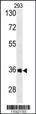 Anti-ANXA2 Rabbit Polyclonal Antibody