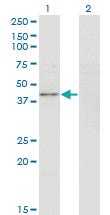 Anti-PPP1R8 Mouse Monoclonal Antibody [clone: 4B5]