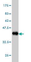 Anti-STK38 Mouse Monoclonal Antibody [clone: 6G11]