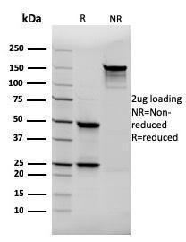 Anti-Thyroglobulin Mouse Recombinant Antibody [clone: rTGB24]