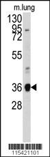 Anti-ANXA2 Rabbit Polyclonal Antibody