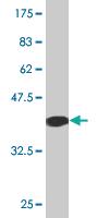 Anti-EPOR Mouse Monoclonal Antibody [clone: 3F6]