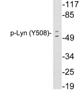 Western blot analysis of lysates from 293 cells treated with H2O2 using Anti-Lyn (phospho Tyr508) Antibody