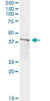 Anti-PPP1R8 Mouse Monoclonal Antibody [clone: 4B5]