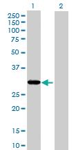 Anti-THAP1 Mouse Polyclonal Antibody