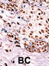 Anti-MET Rabbit Polyclonal Antibody (AP (Alkaline Phosphatase))