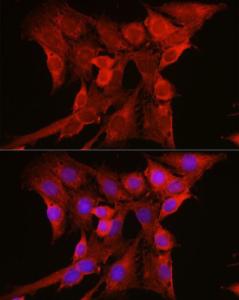 Immunofluorescence analysis of C6 cells using Anti-NRAS Antibody (A15785) at a dilution of 1:100 (40x lens). DAPI was used to stain the cell nuclei (blue).