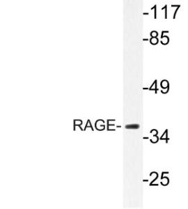 Western blot analysis of lysate from LOVO cells using Anti-RAGE Antibody