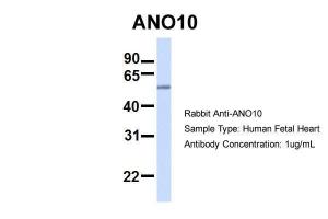 Anti-ANO10 Rabbit Polyclonal Antibody