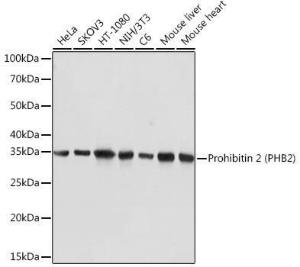 Western blot analysis of extracts of various cell lines, using Anti-REA Antibody [ARC1449] (A308350) at 1:5,000 dilution. The secondary antibody was Goat Anti-Rabbit IgG H&L Antibody (HRP) at 1:10,000 dilution.