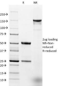 SDS-PAGE analysis of Anti-EpCAM Antibody [EGP40/1384] under non-reduced and reduced conditions; showing intact IgG and intact heavy and light chains, respectively. SDS-PAGE analysis confirms the integrity and purity of the antibody