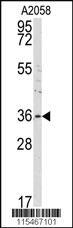 Anti-ANXA2 Rabbit Polyclonal Antibody