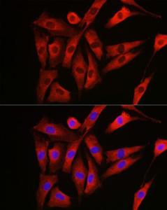 Immunofluorescence analysis of NIH/3T3 cells using Anti-NRAS Antibody (A15785) at a dilution of 1:100 (40x lens). DAPI was used to stain the cell nuclei (blue).