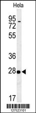 Anti-RRP7A Rabbit Polyclonal Antibody