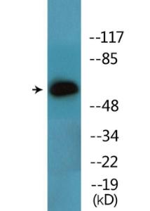 Western blot analysis of lysates from Jurkat cells using Anti-Lck (phospho Tyr393) Antibody