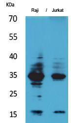 Anti-IL4 antibody