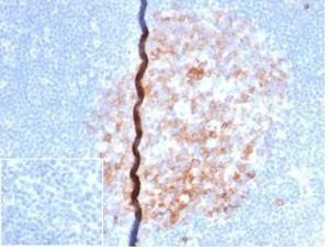 Immunohistochemical analysis of formalin-fixed, paraffin-embedded human lymph node using Anti-CD86 Antibody [rC86/6872] at 2 µg/ml in PBS for 30 minutes at room temperature. Inset: PBS instead of the primary antibody. Secondary antibody negative control