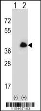 Anti-ANXA2 Rabbit Polyclonal Antibody