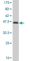 Anti-NFIC Mouse Monoclonal Antibody [clone: 1D6]