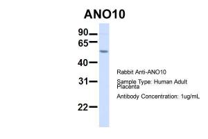 Anti-ANO10 Rabbit Polyclonal Antibody