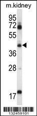 Anti-ACADL Rabbit Polyclonal Antibody (HRP (Horseradish Peroxidase))