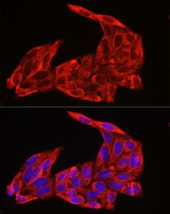 Immunofluorescence analysis of U2OS cells using Anti-NRAS Antibody (A15785) at a dilution of 1:100 (40x lens). DAPI was used to stain the cell nuclei (blue).