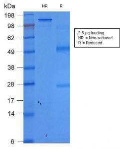 SDS-PAGE analysis of Anti-EpCAM Antibody [rEGP40/1372] under non-reduced and reduced conditions; showing intact IgG and intact heavy and light chains, respectively. SDS-PAGE analysis confirms the integrity and purity of the antibody