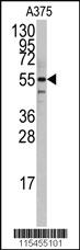 Anti-PTRF Rabbit Polyclonal Antibody