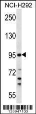 Anti-TMPRSS7 Rabbit Polyclonal Antibody (AP (Alkaline Phosphatase))