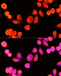 Immunofluorescence analysis of Hela cells using Anti-GSTK1 Antibody (A307380) at a dilution of 1:100 (40x lens). DAPI was used to stain the cell nuclei (blue)